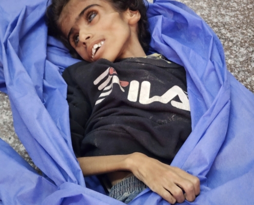 Hunger in Gaza
